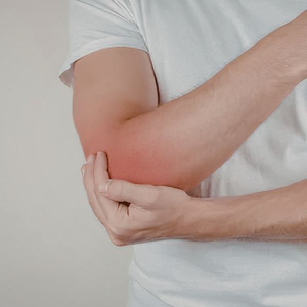 A person in a white shirt holds their red, irritated elbow with a hand, suggesting discomfort or inflammation against a neutral background.